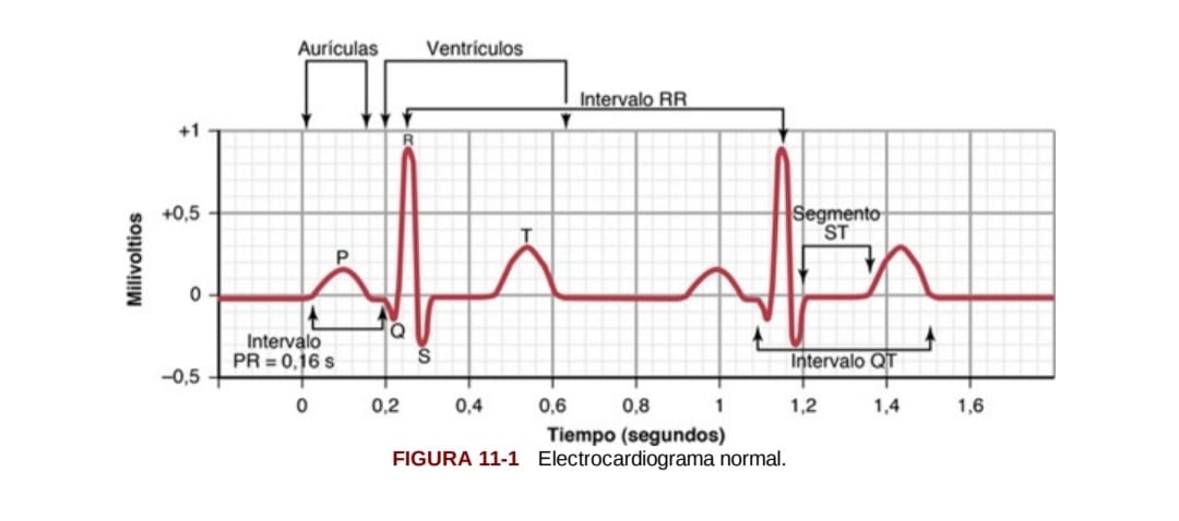 ecg
